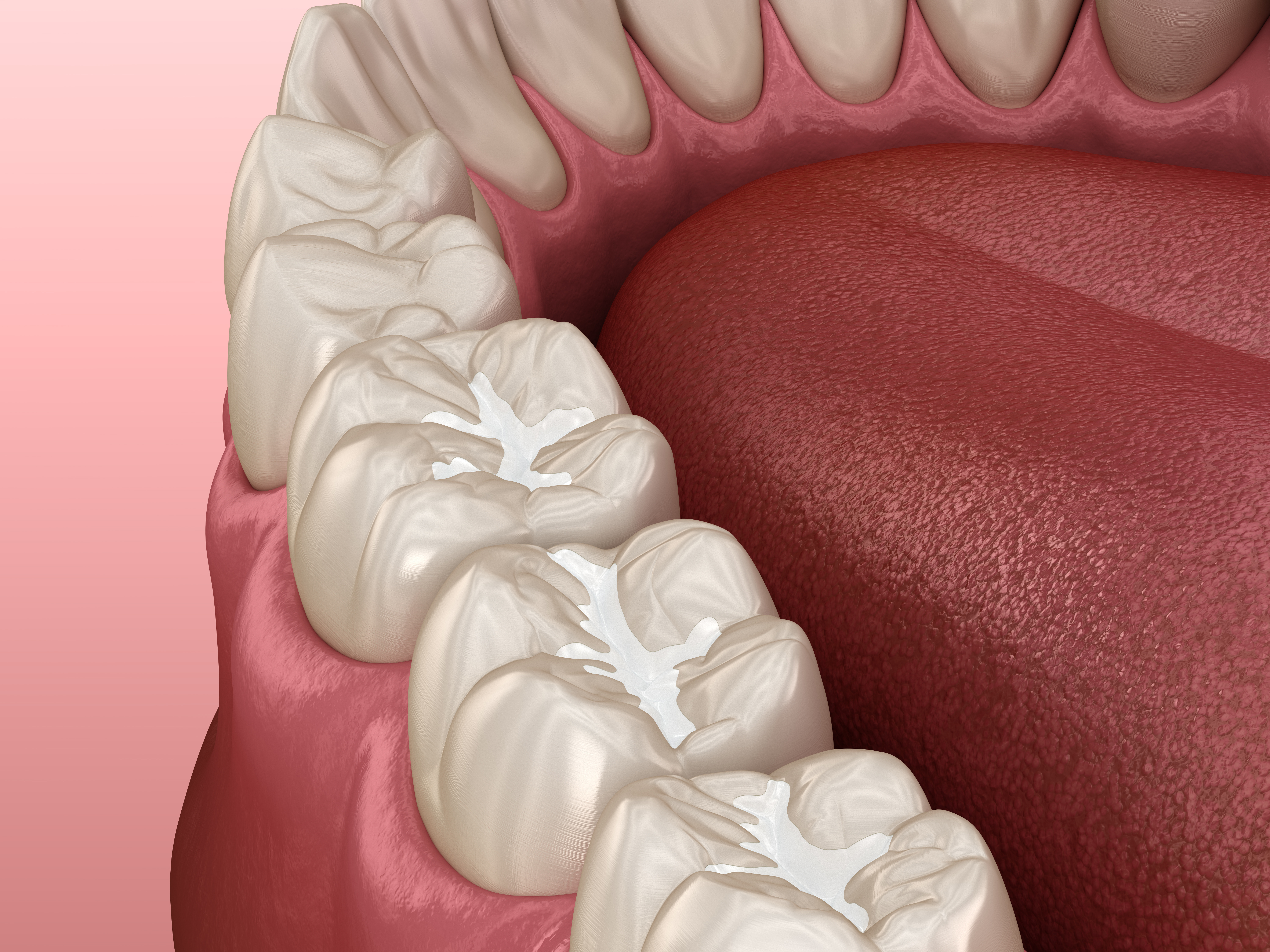 Tooth-Colored Fillings at Integrity Dental Group