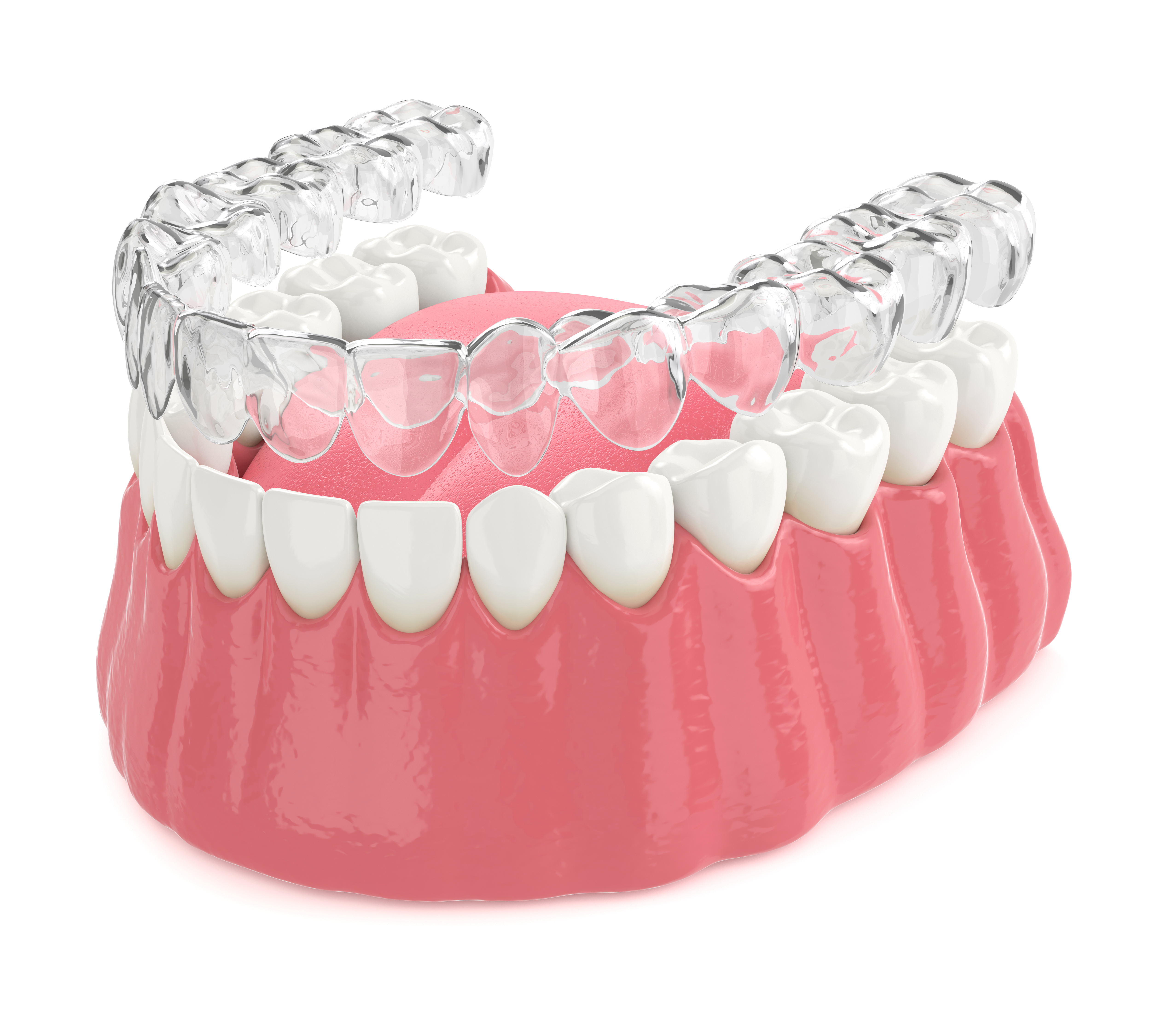 Invisalign at Integrity Dental Group