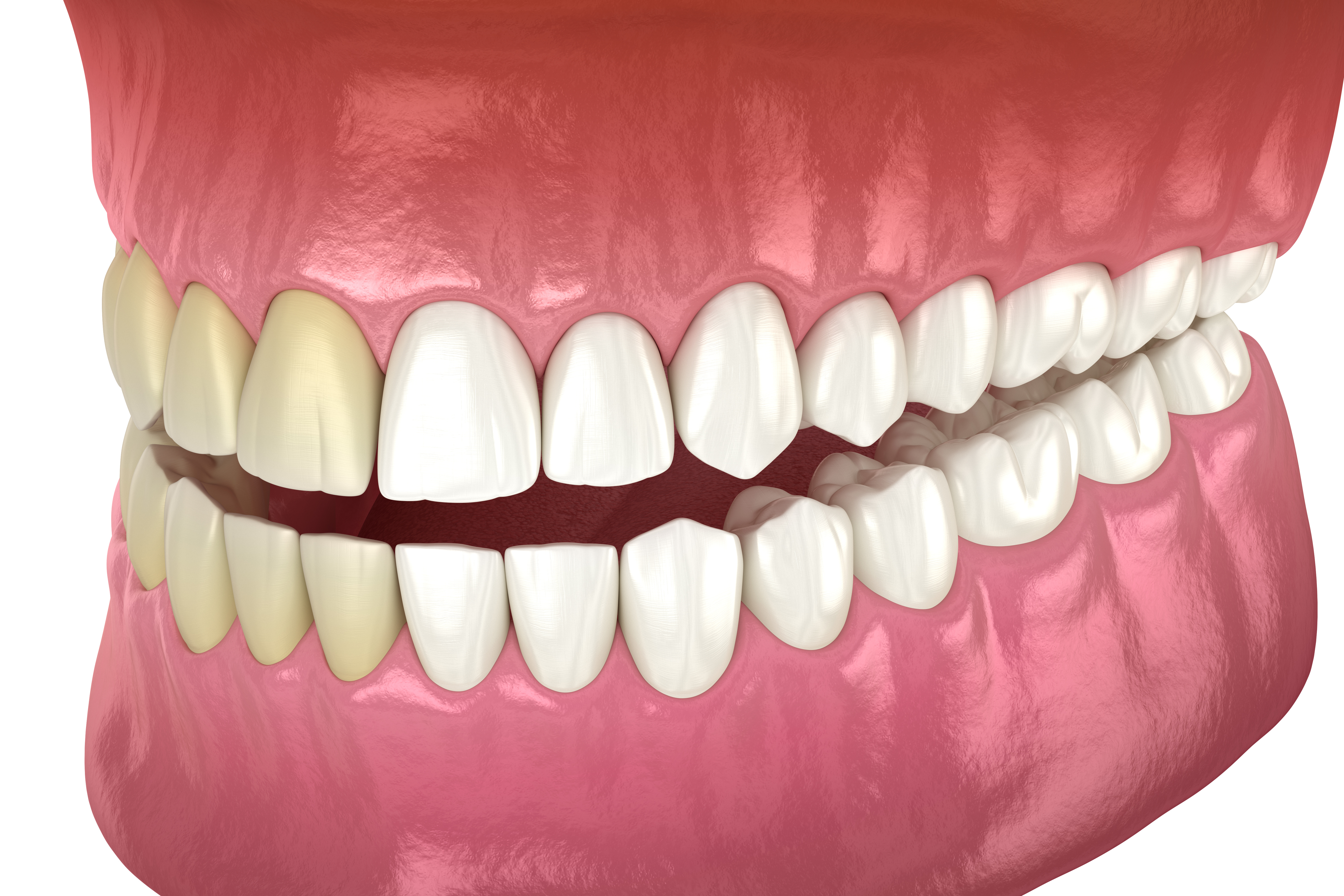 Teeth Whitening Tips Before New Year Photos in Chagrin Falls OH