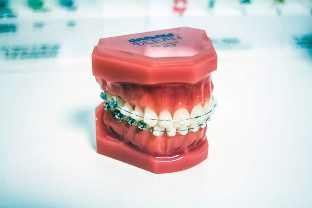retainer